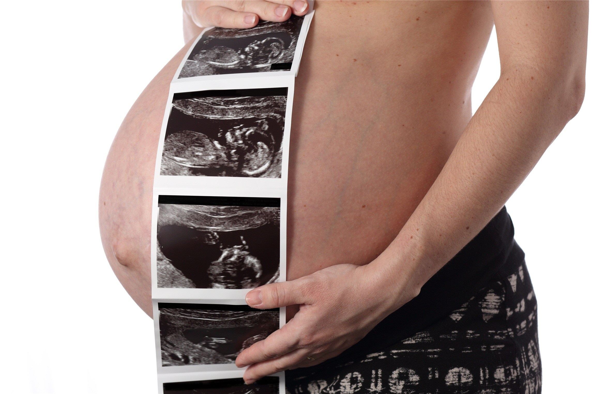 许昌a卵b怀高端机构：男性胎儿的超声波图像显示，这个男孩的阴茎看起来是这样的。